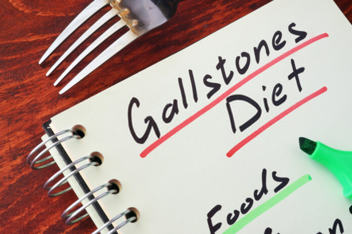 treat gallstones