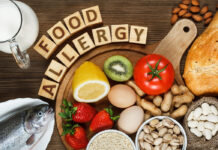 Some Of The Worst Cases Of Food Allergies Food Allergies
