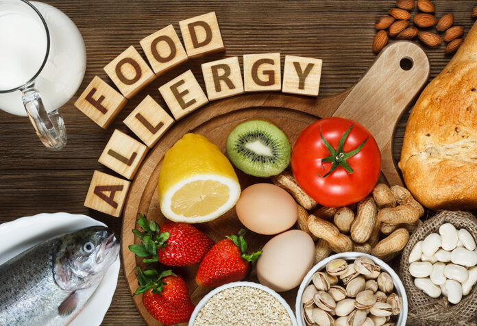 Food Allergies
