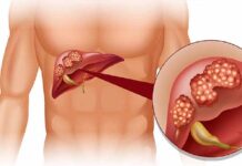 Who Can Use an At-home Liver Test? Who Can Use an At-home Liver Test?