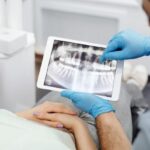 Surgery for Your Smile: The Fascinating Realm of Oral and Maxillofacial Surgery Surgery for Your Smile: The Fascinating Realm of Oral and Maxillofacial Surgery