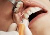 Family Dental Health: A Comprehensive Guide to Dentists and Dental Implants A Comprehensive Guide to Dentists and Dental Implants