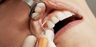 Family Dental Health: A Comprehensive Guide to Dentists and Dental Implants A Comprehensive Guide to Dentists and Dental Implants