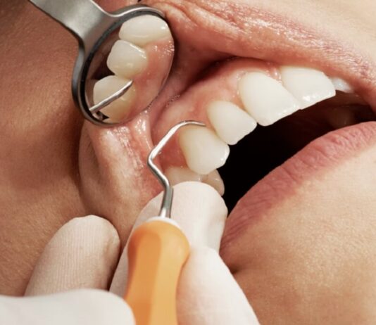 Family Dental Health: A Comprehensive Guide to Dentists and Dental Implants A Comprehensive Guide to Dentists and Dental Implants